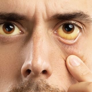 Ayuda a prevenir enfermedades oculares